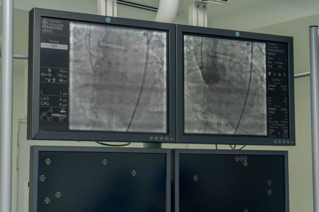 Procedimiento TAVI en Clinica Maicao
